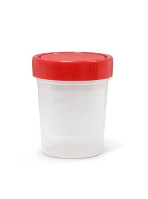 FRASCOS DE TOMA DE MUESTRA DE ORINA 100ml